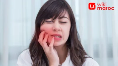Sakit Gigi